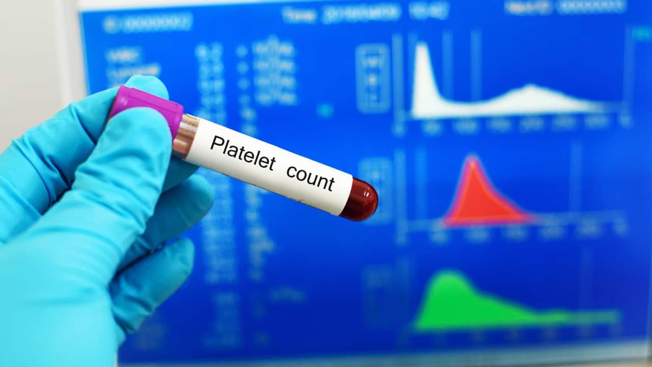 Platelets, or thrombocytes, are small, colourless cell fragments in the blood that play a crucial role in clotting. When blood vessels are injured, platelets clump together to form clots, preventing excessive bleeding. A drop in platelet count, a condition known as thrombocytopenia, can lead to symptoms like easy bruising, prolonged bleeding from cuts, nosebleeds, bleeding gums, and excessive menstrual bleeding. In severe cases, internal bleeding can occur, posing significant health risks. Causes of low platelet count include autoimmune disorders, certain medications, infections, and medical treatments like chemotherapy. Prompt medical attention is essential to manage and treat thrombocytopenia effectively (Image: Canva) Platelets, or thrombocytes, are small, colourless cell fragments in the blood that play a crucial role in clotting. When blood vessels are injured, platelets clump together to form clots, preventing excessive bleeding. A drop in platelet count, a condition known as thrombocytopenia, can lead to symptoms like easy bruising, prolonged bleeding from cuts, nosebleeds, bleeding gums, and excessive menstrual bleeding. In severe cases, internal bleeding can occur, posing significant health risks. Causes of low platelet count include autoimmune disorders, certain medications, infections, and medical treatments like chemotherapy. Prompt medical attention is essential to manage and treat thrombocytopenia effectively (Image: Canva)