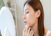 Get clear skin after acne: Here's how to remove pimple scars