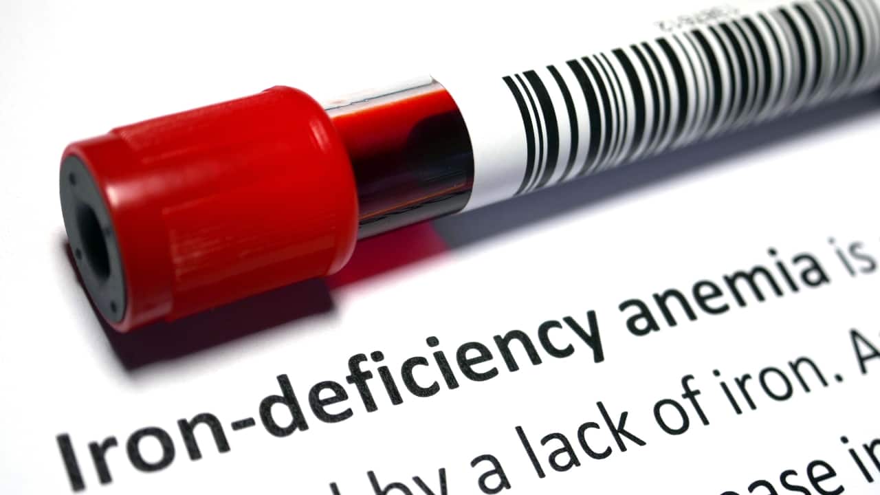 Iron deficiency occurs when the body's iron levels are insufficient to meet its needs. This deficiency can progress to iron deficiency anemia, marked by a decrease in the number of red blood cells or hemoglobin. Hemoglobin is essential for oxygen transportation; without adequate haemoglobin, tissues and organs do not receive enough oxygen, resulting in fatigue and weakness (Image: Canva)