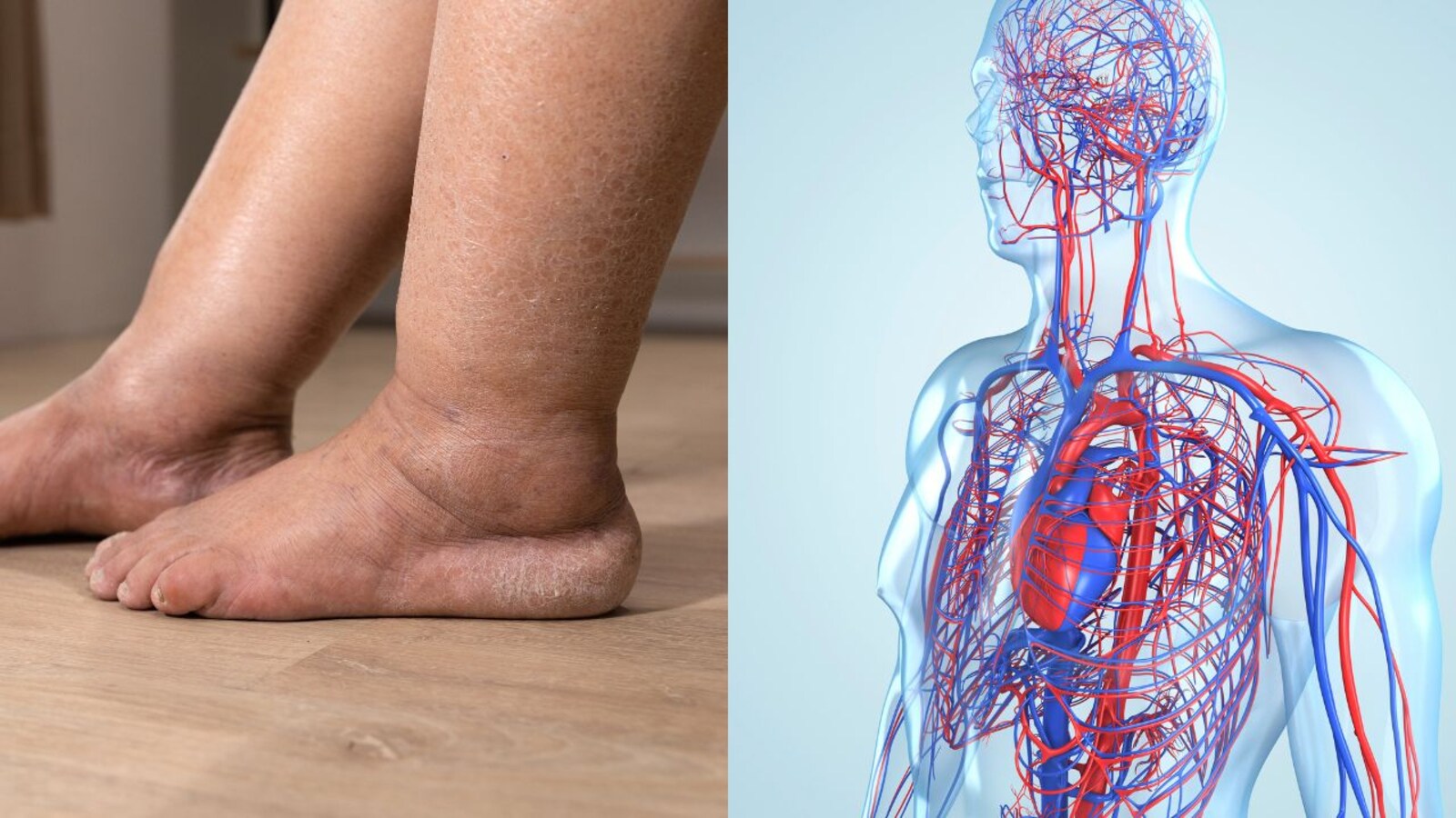 Symptoms of poor blood circulation: Cold hands and feet, swelling, numbness  among warning signs