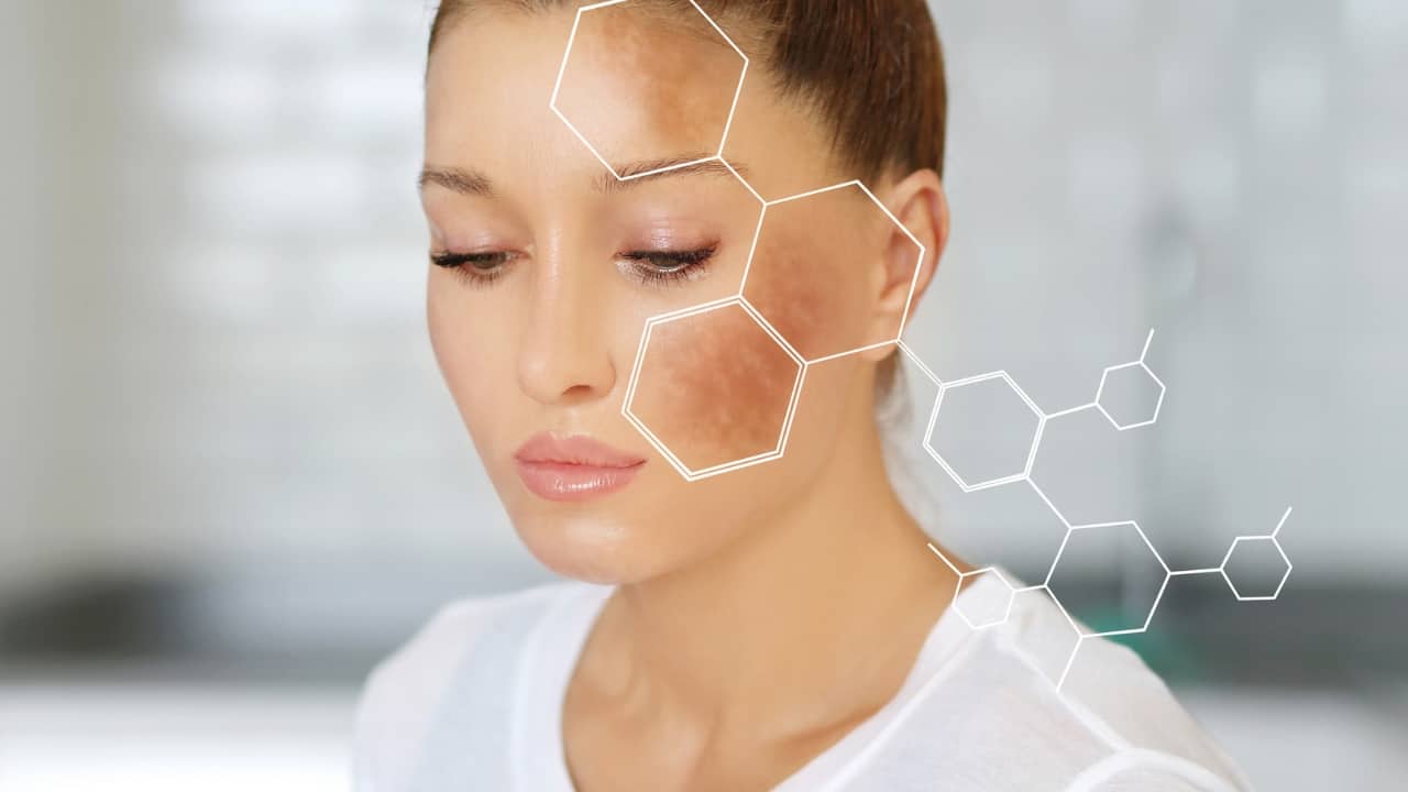 Skin care tips: Reduce dark spots, pigmentation with sunscreen, vitamin C, niacinamide Skin care tips: Reduce dark spots, pigmentation with sunscreen, vitamin C, niacinamide
