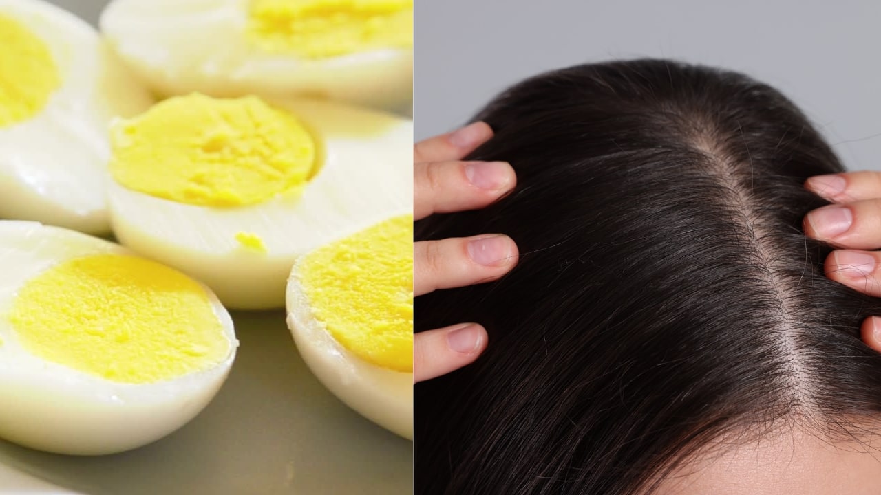 10.Promotes healthy hair: Biotin, a B-vitamin found in eggs, is known to improve hair strength and prevent hair loss. Protein and other nutrients in eggs contribute to hair health by supporting growth and reducing brittleness. (Image: Canva)