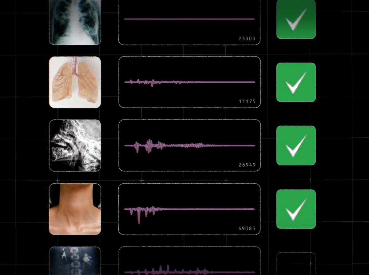 Google's AI model to help researchers identify TB, other diseases from the sound of cough