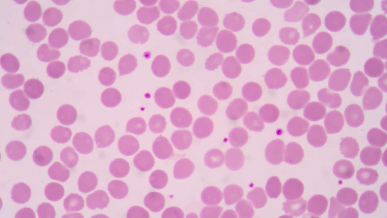 Dengue fever can lead to a decrease in platelet count, which is a concern because low platelets (thrombocytopenia) can increase the risk of bleeding. While medical treatment is essential, certain natural approaches may help support platelet count recovery. Always consult with a healthcare provider before trying new remedies, especially in the context of a serious illness like dengue. Dr Sapna Rana from RKG Healthcare Hospital, Pune, suggests eight natural ways that might help increase platelet count. (Image: Canva)