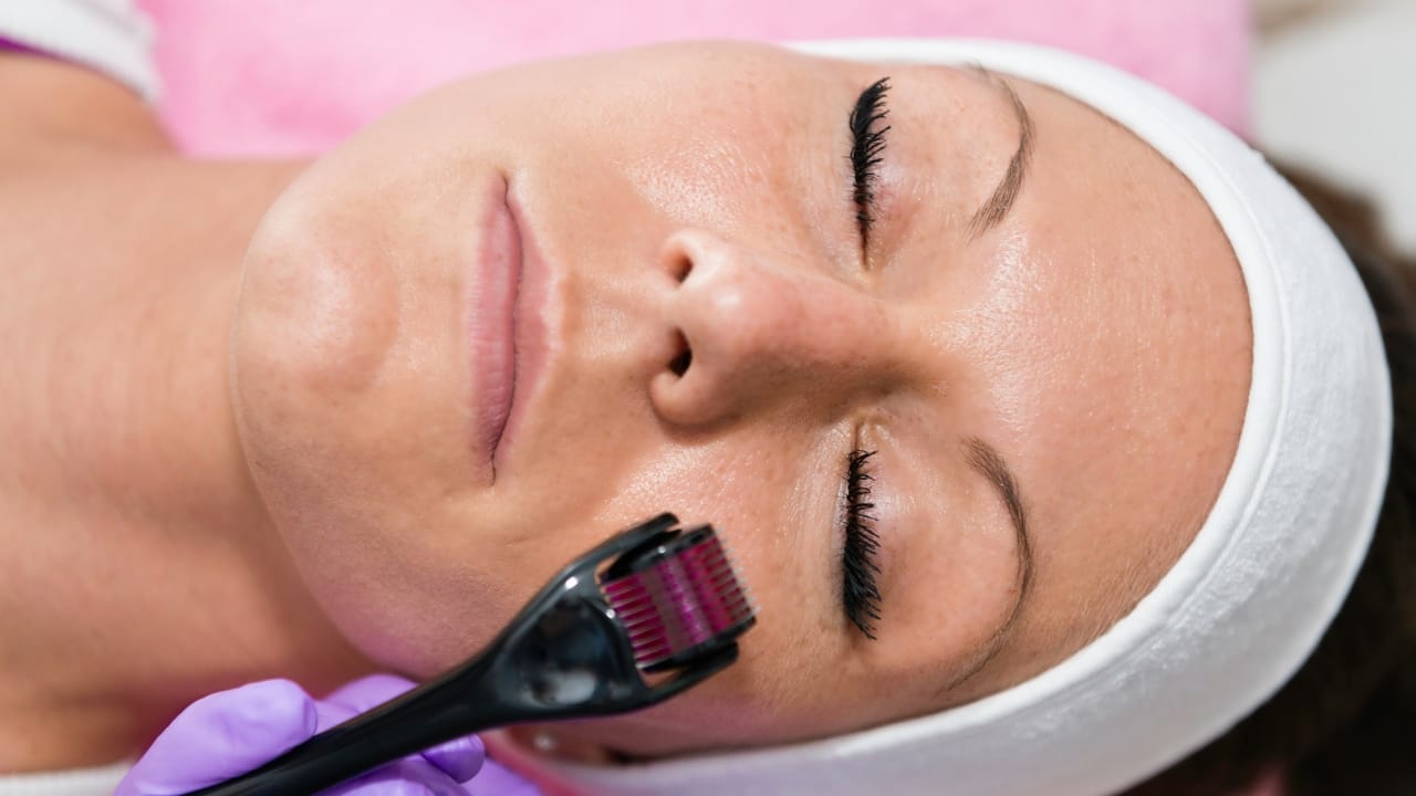 Banish signs of ageing, improve skin texture, and other skin benefits of dermarolling at home