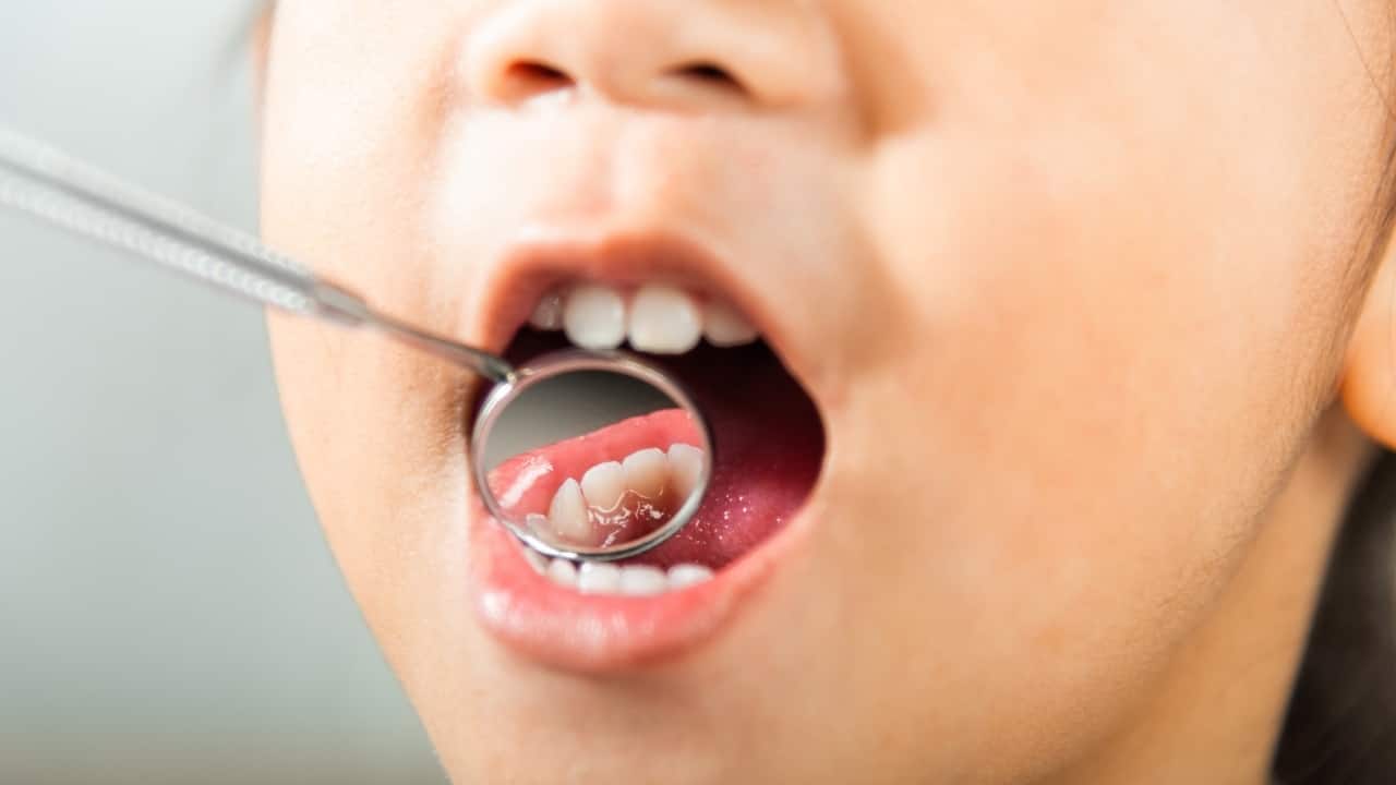 Oral health: Prevent dry mouth and dehydration-related dental problems in summer
