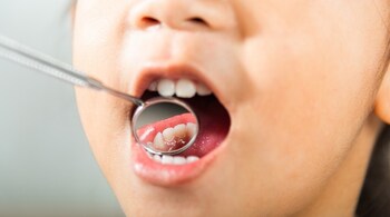 Early access to quality dental treatment increases a child's chances of developing good oral hygiene habits, avoiding dental anxiety, and experiencing fewer dental issues as they age. (Image: Canva)