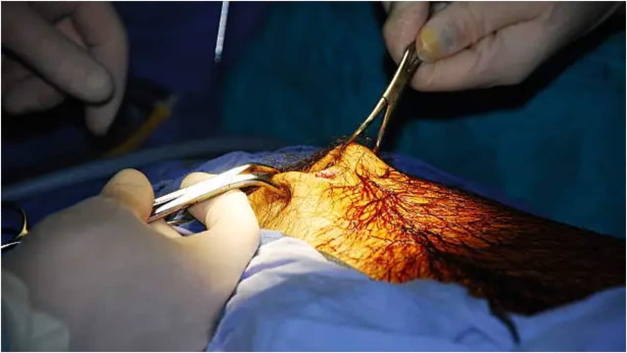 Fake doctor performs surgery with help of YouTube videos, Bihar boy dies