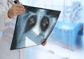 Symptoms of double pneumonia in the elderly: Why early detection is critical