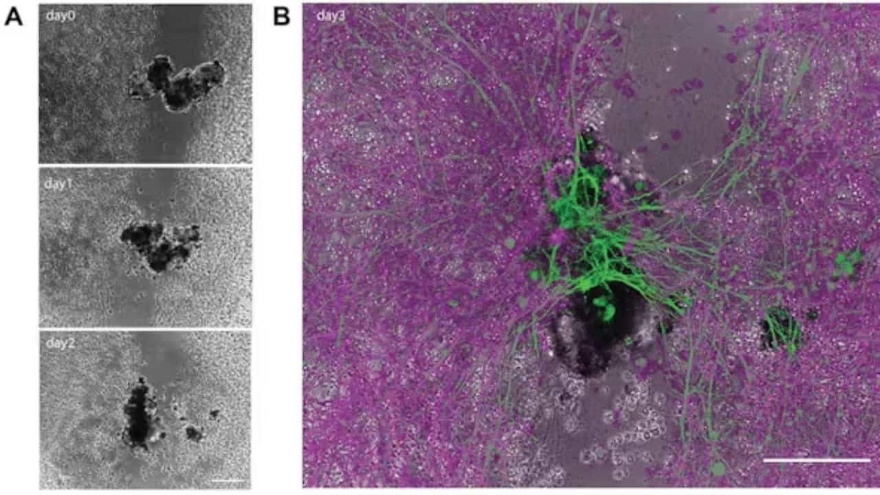 Diagram A depicts an anthrobot constructing a bridge over a damaged neuron, spanning three days. Diagram B illustrates the 'stitch' in green at the conclusion of Day 3. (Image: Gumuskaya et al. 2023/Advanced Science, CC BY-SA)