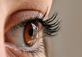 World Sight Day 2024: How to prevent cataract, myopia and other common eye conditions