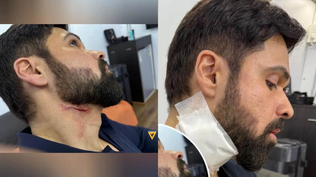 Emraan Hashmi gets injured on the sets of Goodachari 2, suffers deep cut on his neck