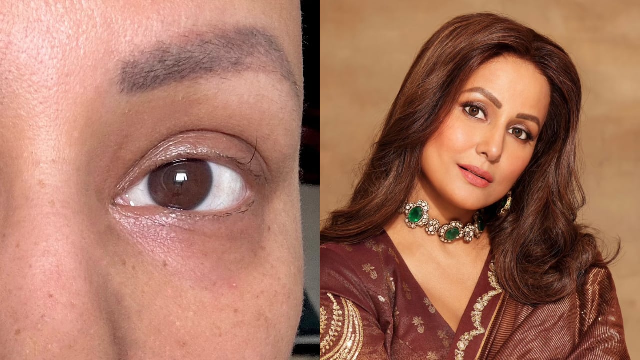 Hina Khan shares pic of her last remaining eyelash as she nears her final chemotherapy session