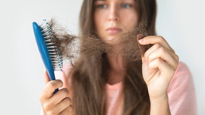 Prevent hair loss: Eat a balanced diet, quit smoking, other tips for healthy hair
