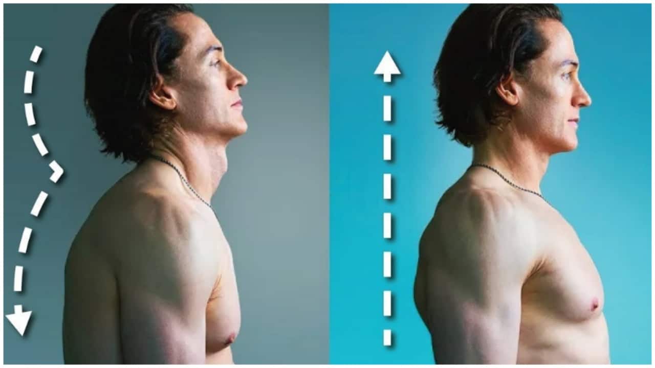 Age reversing CEO Bryan Johnson says his posture was 'killing his brain'. He fixed it with 5 steps Age reversing CEO Bryan Johnson says his posture was 'killing his brain'. He fixed it with 5 steps
