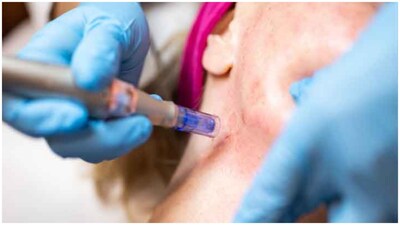A Chinese woman reportedly stabbed her baby hundreds of times with needles. (Pic for representation)
