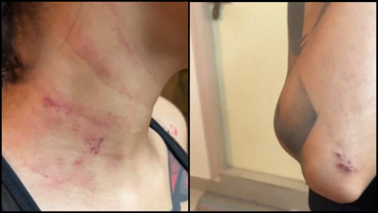 Bengaluru landlord slaps, chokes & assaults woman, allegedly threatens to kill her Bengaluru landlord slaps, chokes & assaults woman, allegedly threatens to kill her