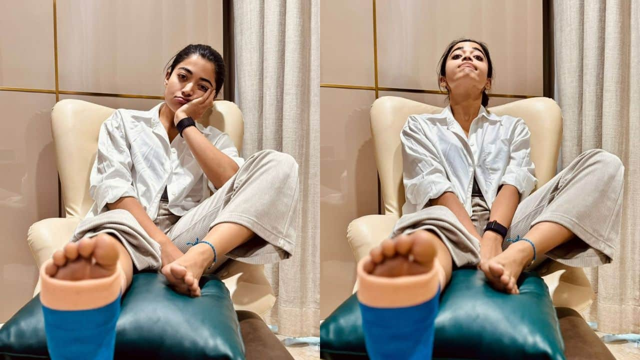 Rashmika Mandanna shares latest update on her leg injury: "I’m in 'hop mode' for the next few weeks..."