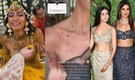 Priyanka Chopra's sister-in-law Neelam Upadhyaya says she got skin allergy after Haldi ceremony, shares pics