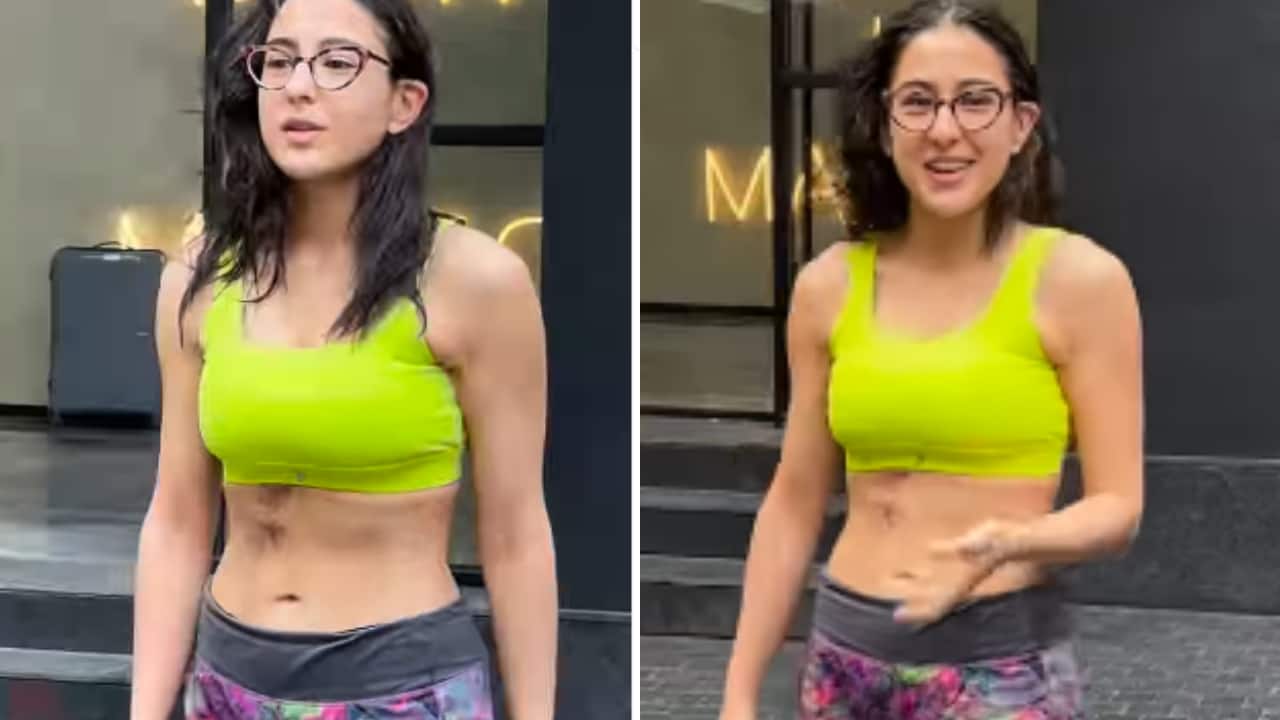 Sara Ali Khan reveals she got burned accidentally, watch video