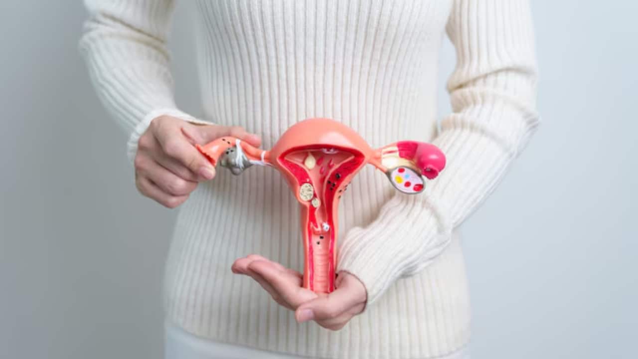 Endometriosis myths debunked: Does pregnancy cure endometriosis? Is endometriosis only a painful period? Endometriosis myths debunked: Does pregnancy cure endometriosis? Is endometriosis only a painful period?
