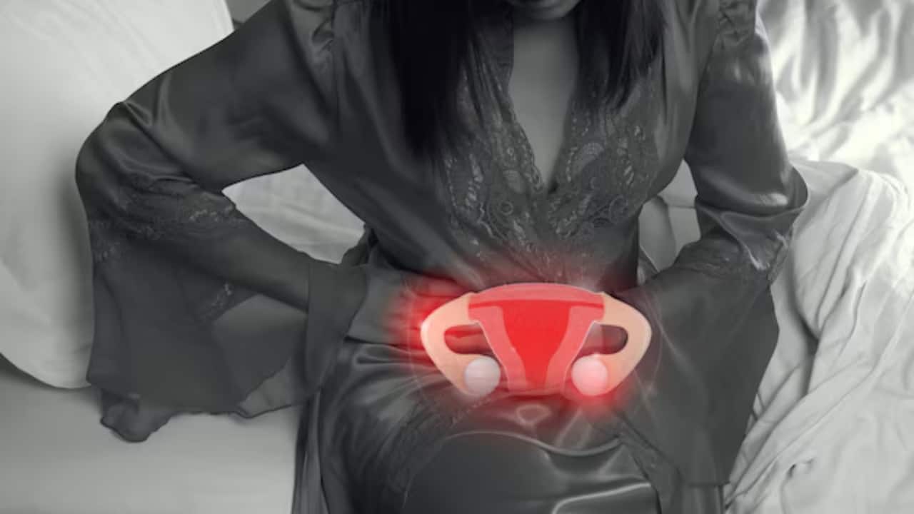 endometriosis causes