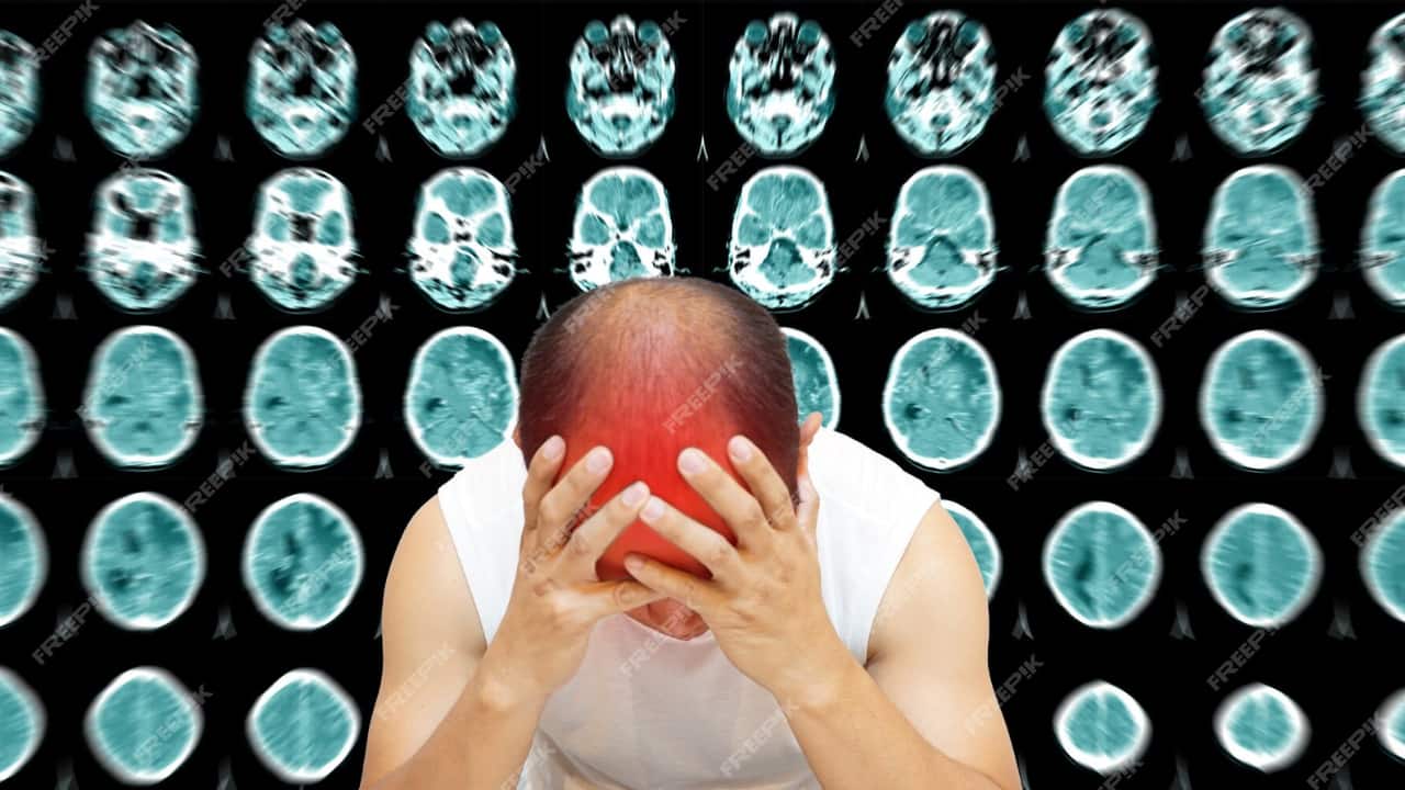 What is viral meningitis? Causes, symptoms and treatment options of this condition