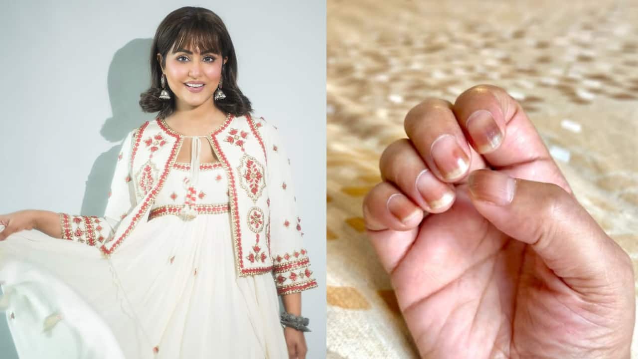 Hina Khan shows her discoloured nails amid cancer diagnosis, says, “most common side effects of chemotherapy”