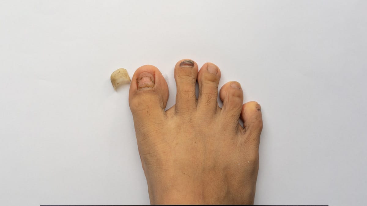 post-thumbnail
