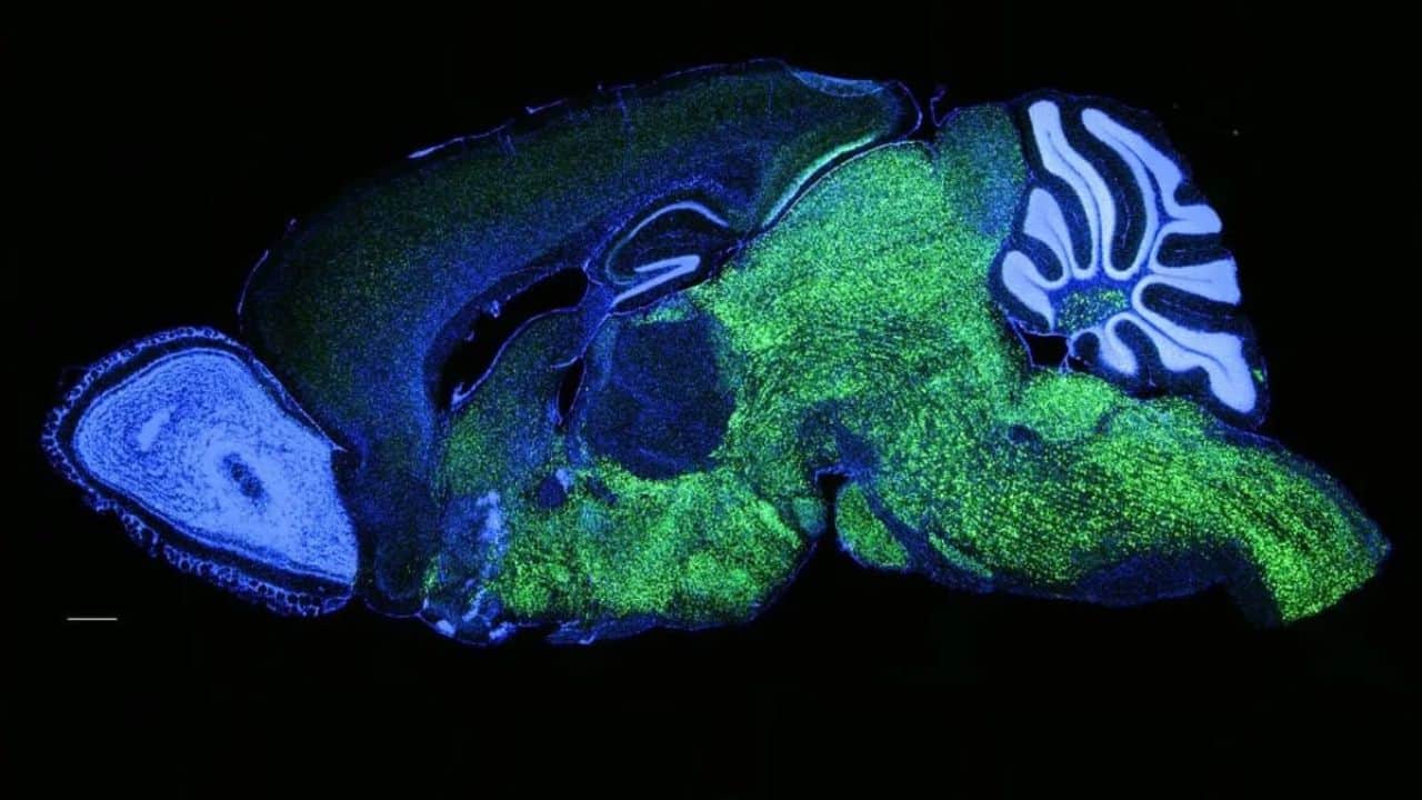 NOVA1 expression pattern in a mouse brain: NOVA1 shown in green, nuclei (DAPI) marked in blue. (Image: Laboratory of Molecular Neuro-oncology at The Rockefeller University)
