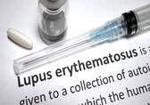 World Lupus Day 2025: Causes, symptoms and treatment options of the autoimmune condition
