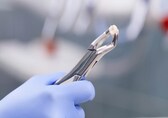 Bone loss to speech issues, here’s how tooth loss affects your whole health