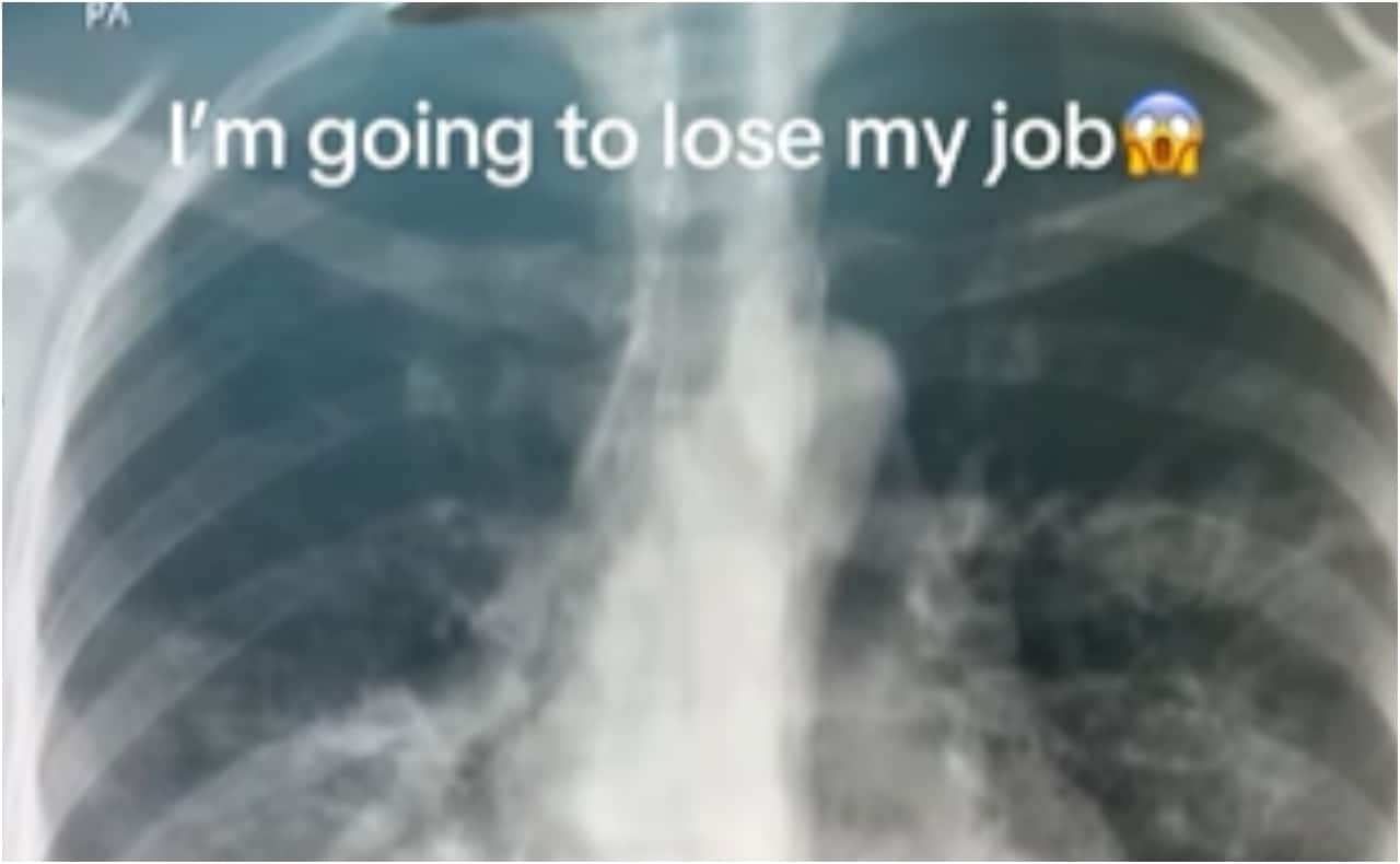 Dubai doctor says he’ll apply to McDonald’s after AI analyses X-ray better than him