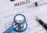 Health alert after Shakira’s concert: Measles case prompts urgent warning, uncover symptoms, causes, more