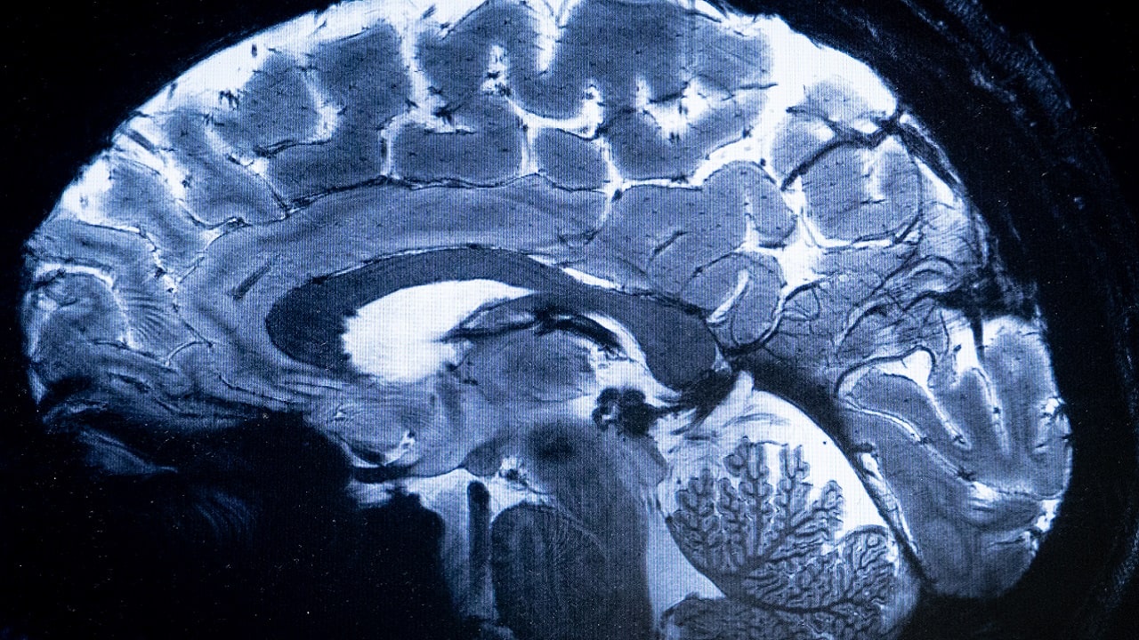 China joins US in brain implant race with clinical trial