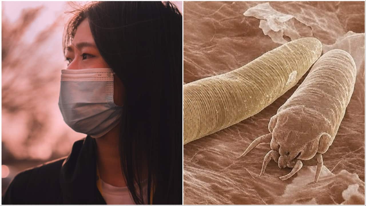 Woman doesn’t remove makeup for 22 years, gets mites on face: ‘Feels like thousands of tiny…’