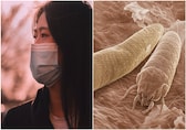 Woman doesn't remove makeup for 22 years, gets mites on face: 'Feels like thousands of tiny...'