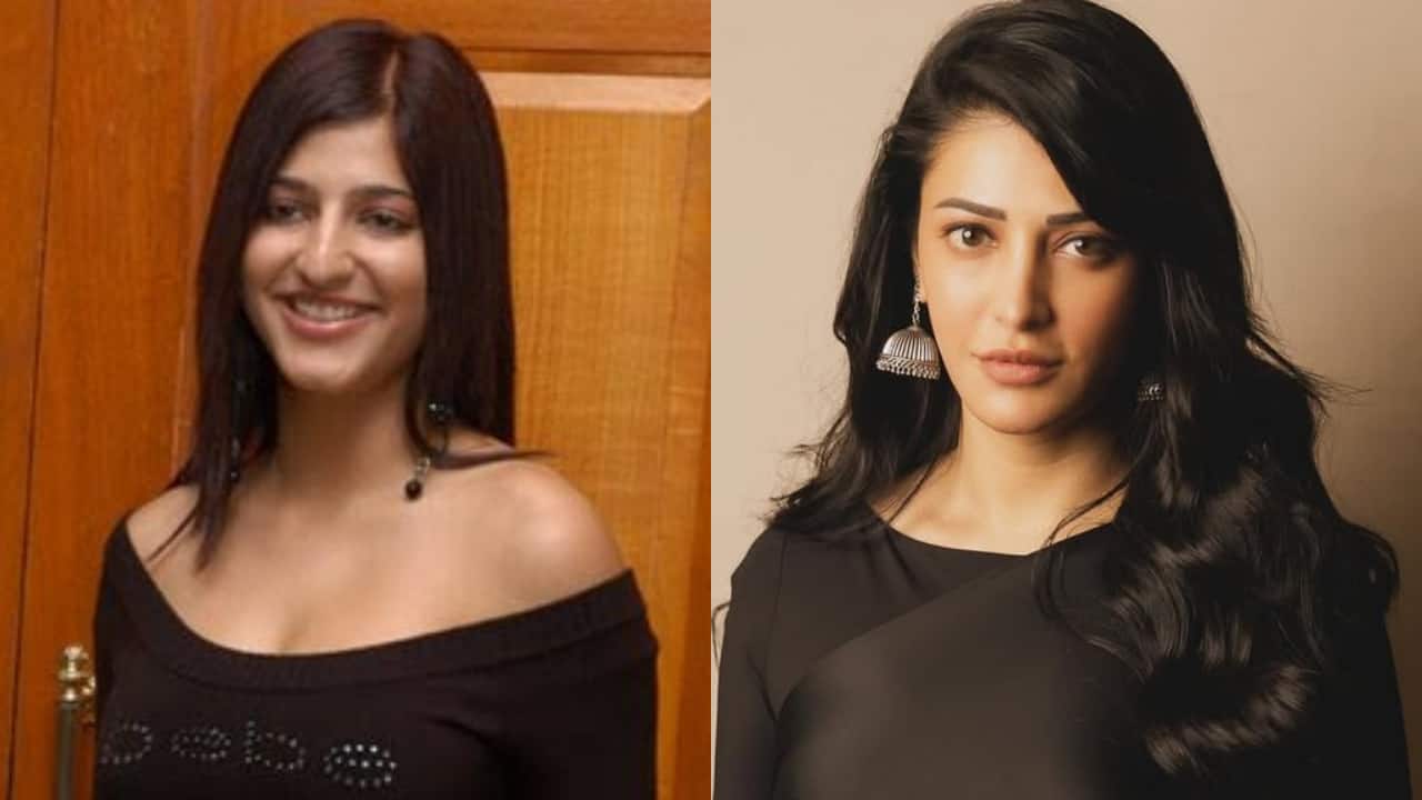 When Shruti Haasan spoke about getting a nose surgery and face fillers: Aapko karna hai karo, nahi karna math karo, Mujhe bass apne...