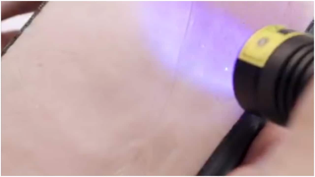 Phone cover that burns like human skin? It’s real, and it wants you to wear sunscreen