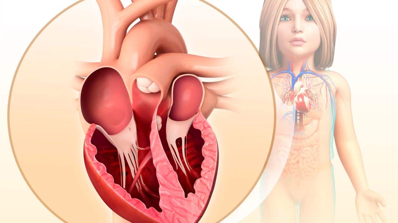 Mitral valve narrowing The heart has four chambers and, consequently, four areas with valves to regulate blood flow. In this condition, the valve thickens, leading to reduced blood flow into the left lower heart chamber (ventricle). Dyspnea occurs in such cases after exertion, like heavy exercises, cycling, running, etc