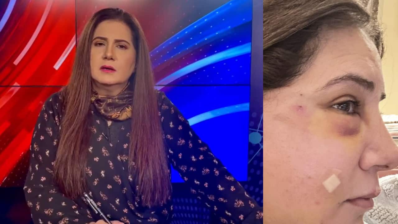 Pakistani senior anchor Jasmeen Manzoor accuses her ex-husband of assault, writes "I have 50 more pictures"