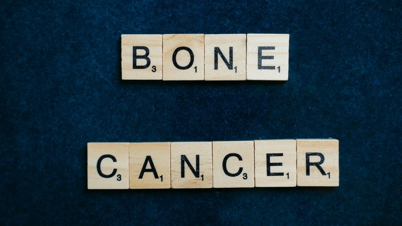 Bone cancer myths busted: What most people get wrong about bone tumours