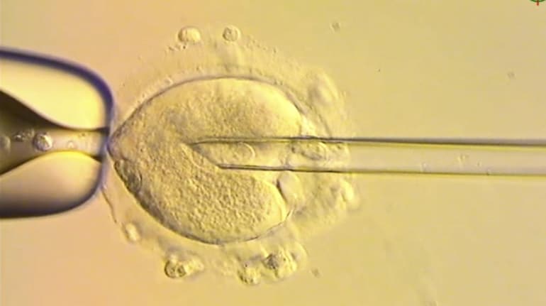 UK scientists successfully use DNA from three people to prevent rare  genetic diseases in babies