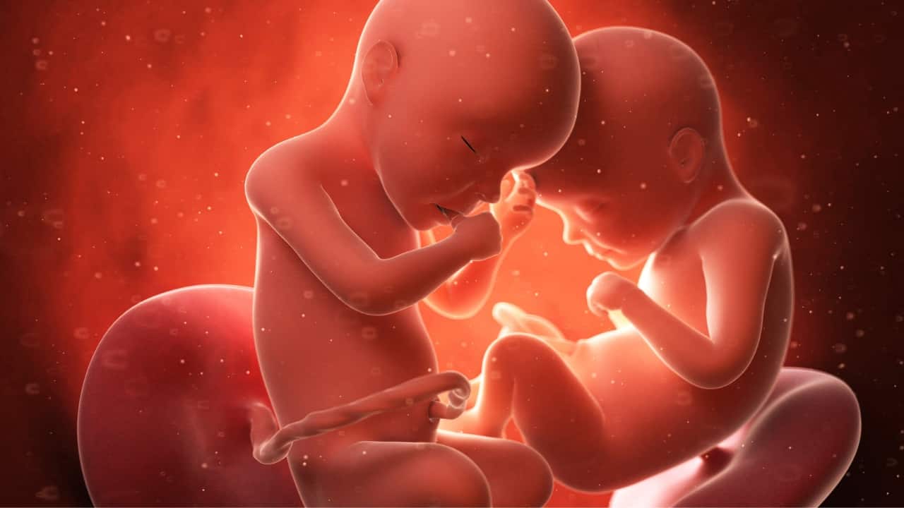 Breech in Twin Pregnancies and Amniotic Fluid Reduction In case of twins, one or both of the babies may be in the breech presentation. It occurs because of the inability of the babies to spontaneously change their position as the amount of space in the womb becomes limited. A reduced amount of amniotic fluid can also lead tonbreech because of similar reasons.