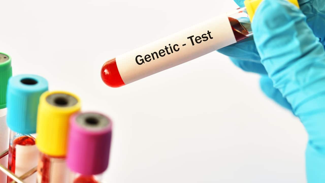 Genetic Disorders and Their Contribution In congenital or genetic conditions like trisomy 13 (Patau Syndrome) or trisomy 21 (Down’s Syndrome), the fetal muscular tone is altered, which can be contributing factor for a breech presentation. Alongside, the baby’s mobility may also be affected which can keep the baby's buttocks towards the pelvis.