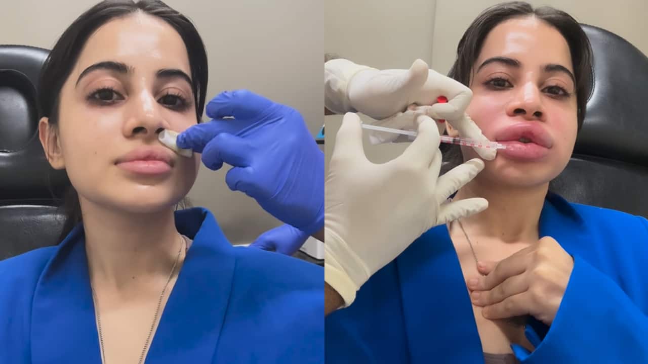 Uorfi Javed shares video of getting lip fillers dissolved: “Will get them again but naturally”