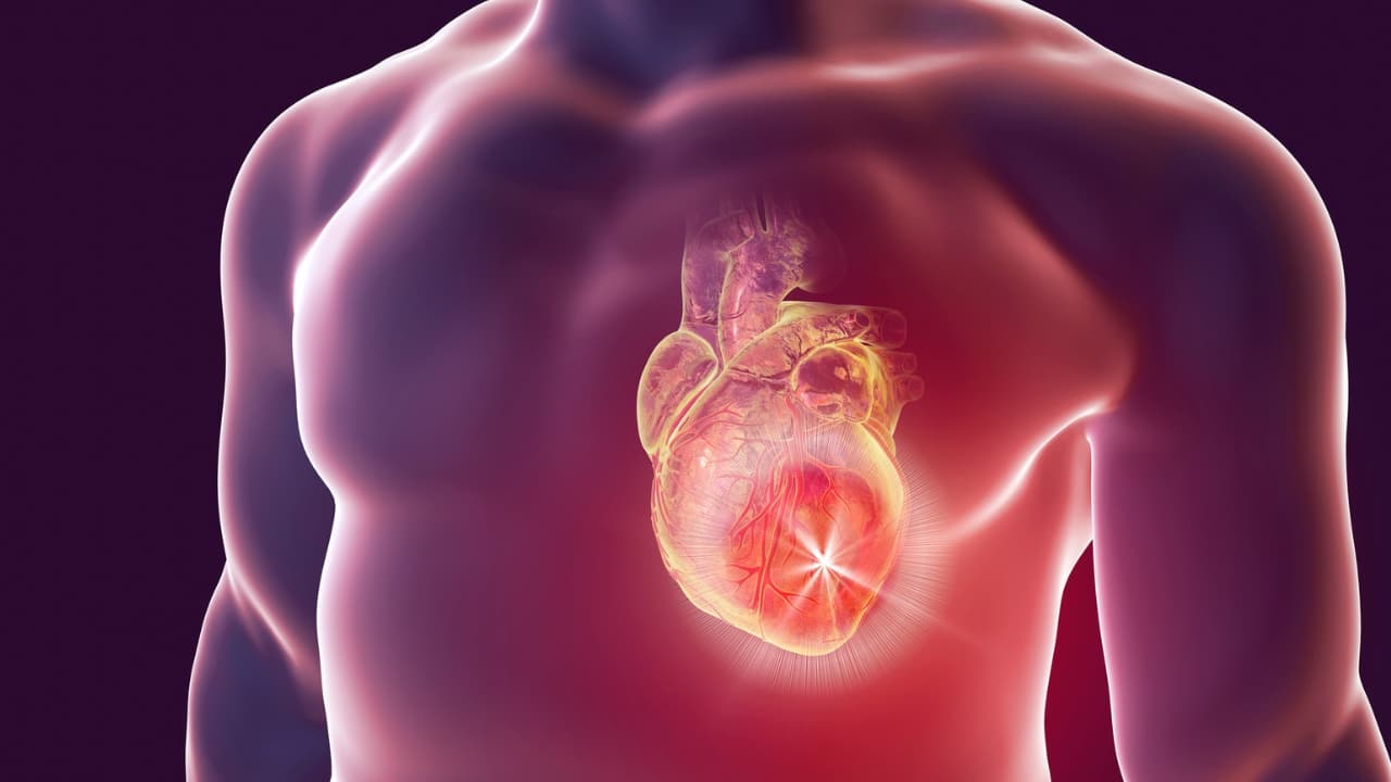What pushes the heart down Diseases that affect the blood supply of the heart like myocardial infarction, or those that cause long-term pressure overload on the heart like raised blood pressure, mitral or tricuspid stenosis, can lead to heart failure. Toxins, drugs, ageing, chronic anemia, increased levels of thyroid hormones and vitamin B deficiency like beriberi are also etiological factors for cardiac failure