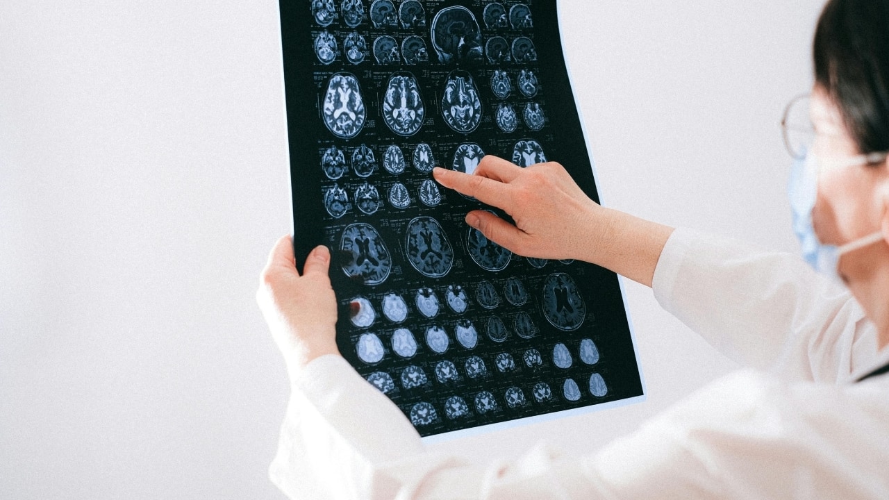 World Brain Health Day 2025: Life-changing brain conditions that are treatable if diagnosed in time