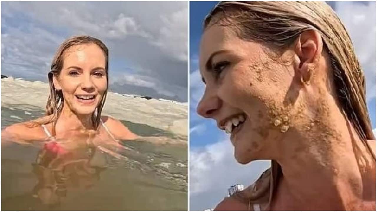 ‘It got in my mouth’: Influencer unknowingly swims in 'raw sewage' on camera, video goes viral ‘It got in my mouth’: Influencer unknowingly swims in 'raw sewage' on camera, video goes viral