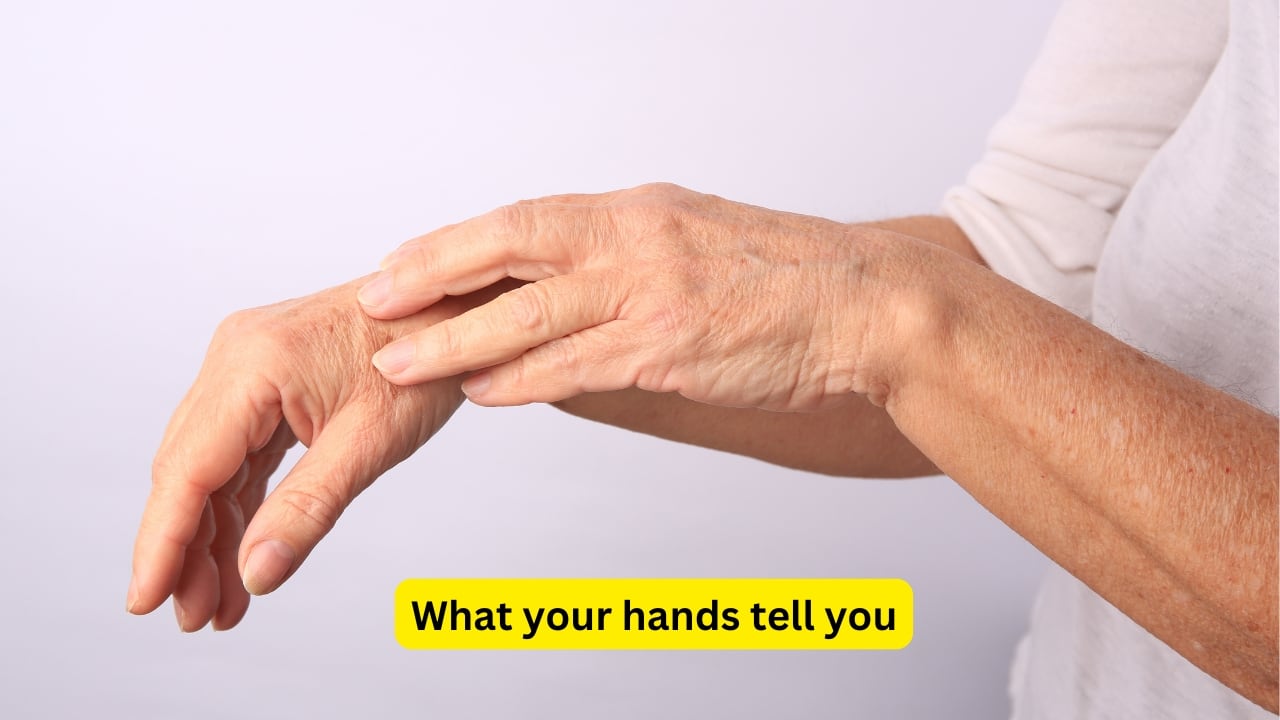 Spot Trouble Early: 10 Health Clues Hidden in Your Hands